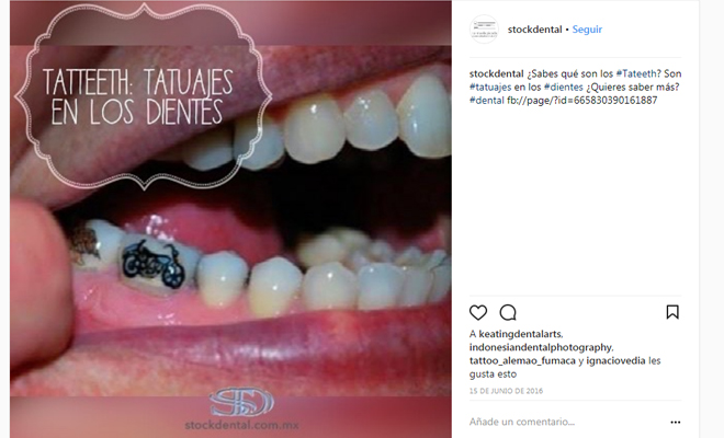 218604-tatteeth Tatteeth o tatuajes en los dientes