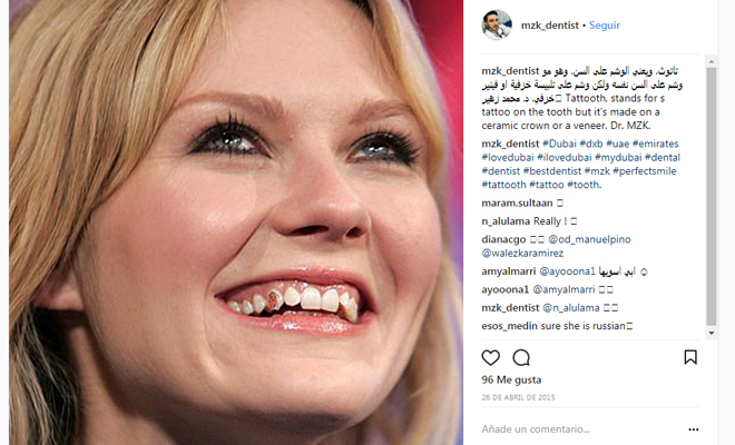 218604-tatteeth Tatteeth o tatuajes en los dientes