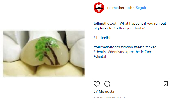 218604-tatteeth Tatteeth o tatuajes en los dientes