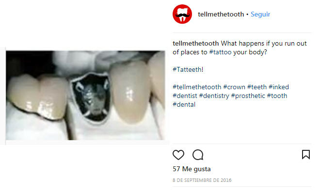 218604-tatteeth Tatteeth o tatuajes en los dientes