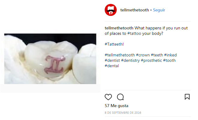 218604-tatteeth Tatteeth o tatuajes en los dientes
