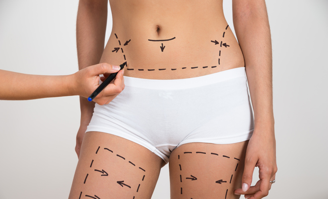 cirugía estética cirugía estética