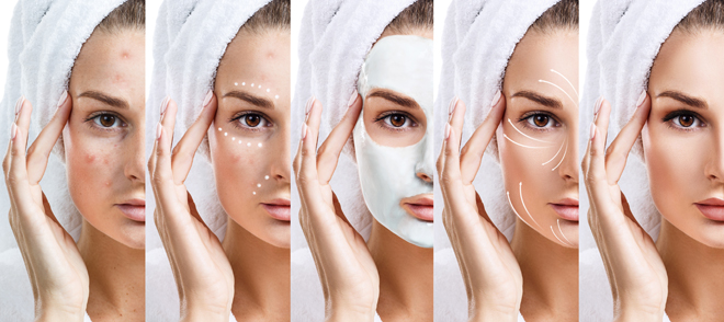 Granos en el rostro Granos en el rostro