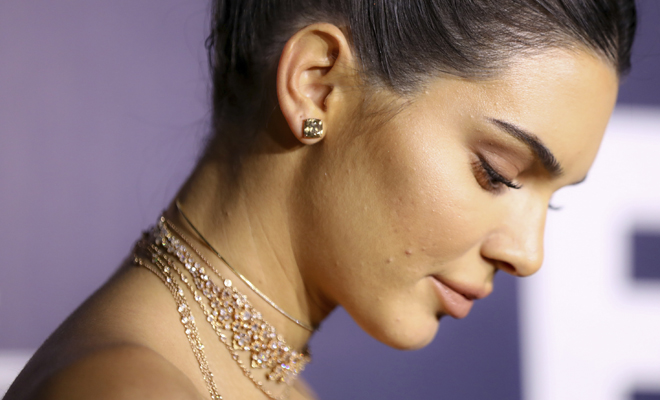 Kendall Jenner, piel con tendencia acneica Kendall Jenner, piel con tendencia acneica