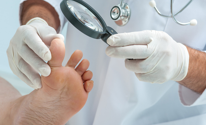 El mejor tratamiento para los hongos de las uñas de los pies El mejor tratamiento para los hongos de las uñas de los pies