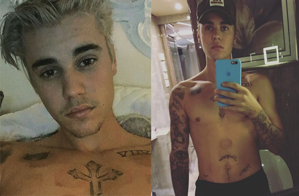 Justin Bieber muestra sus marcas de 'cupping'