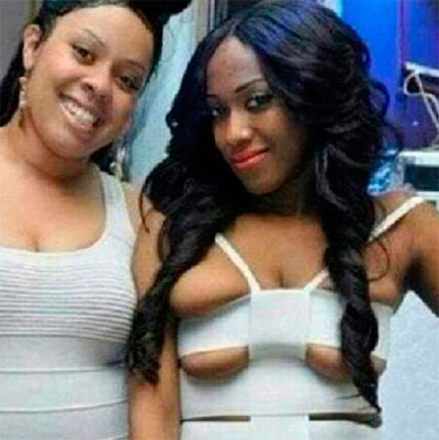 Quizá sería conveniente que te probaras una talla más de este vestido. 