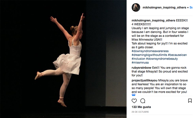 Esta mujer con síndrome de Down lucha por sus sueños