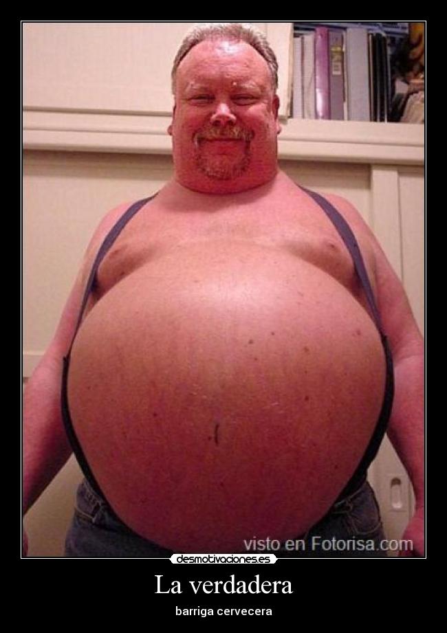 Barriga cervecera