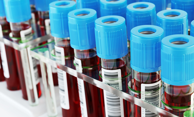 Tengo miedo a la sangre: Qué es la hematofobia