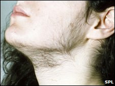 Mujeres con patillas