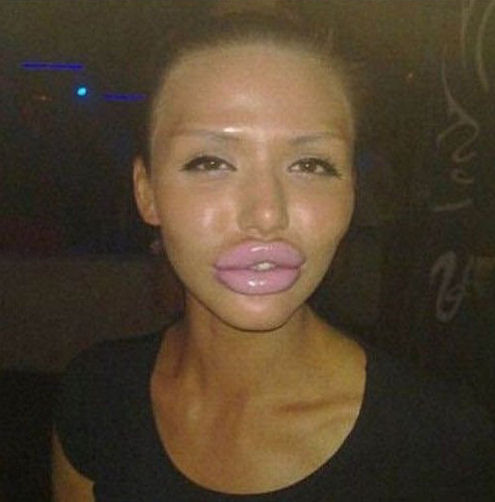 Operaciones de labios