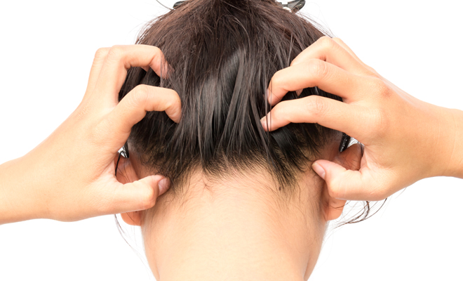 El verdadero significado de soñar con piojos El verdadero significado de soñar con piojos