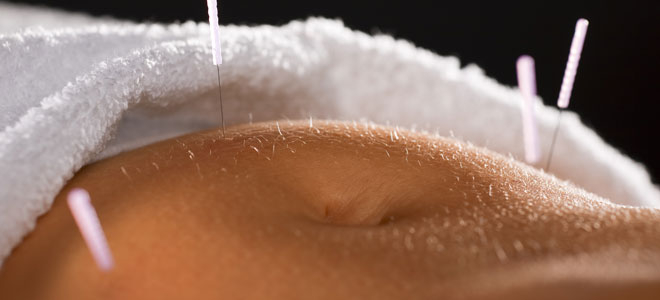 Acupuntura para el dolor de estómago