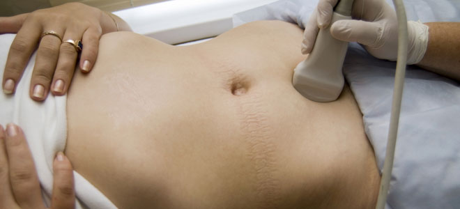 Cuándo ir al médico si nos duele el estómago