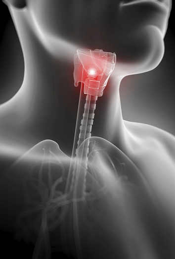 Dolor de garganta por infección vírica