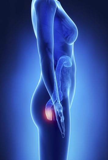 Las hemorroides, qué son