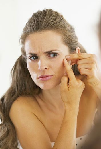 Acné a los 30 años, ¿por qué salen granos? Acné a los 30 años, ¿por qué salen granos?