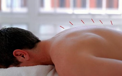 Dolor de espalda, acupuntura Situaciones incómodas en los tratamientos