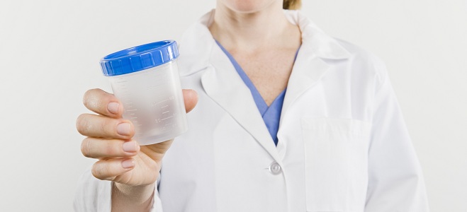 alimentos prohibidos para el ácido úrico