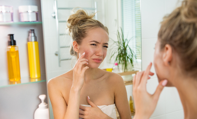 El tratamiento para los granos hormonales El tratamiento para los granos hormonales