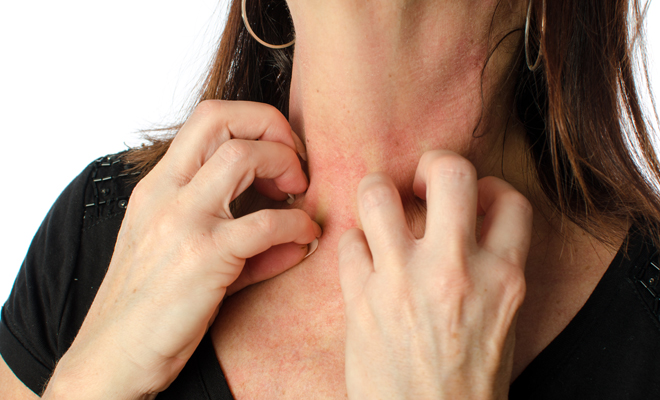 Qué hacer en caso de tener alergia al calor Qué hacer en caso de tener alergia al calor