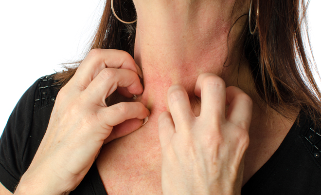 Alergia al maquillaje: ¡Atenta si notas estos síntomas!