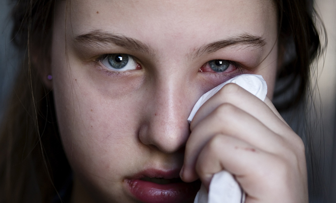 Conjuntivitis: qué es y tipos de conjuntivitis que hay