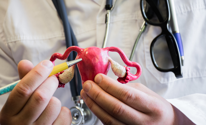 Tratamiento para la endometriosis Tratamiento para la endometriosis